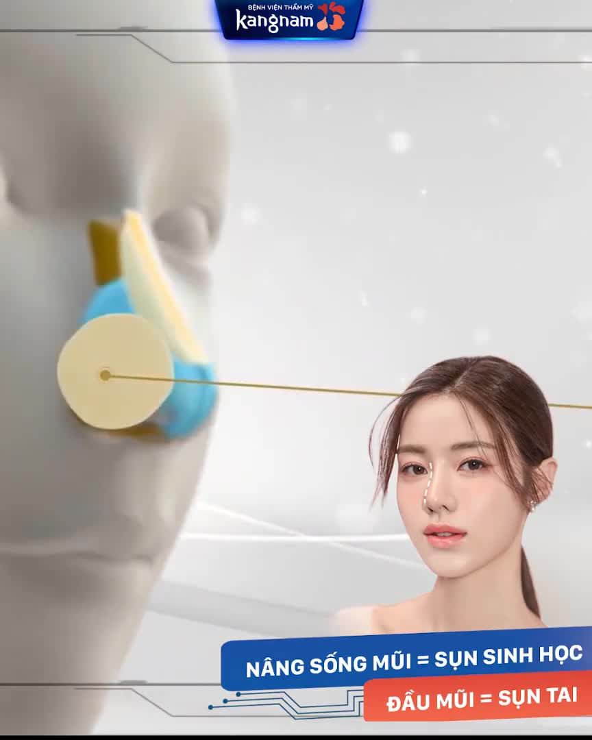 NÂNG MŨI K NOSE  MŨI "BAY" CHUẨN HÀN