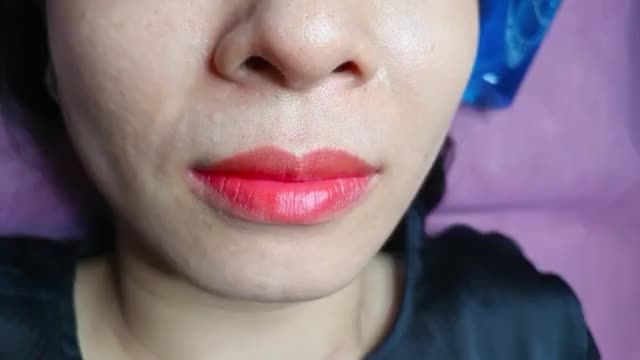 Phun môi BabyLips đẹp ngay tức thì, ít sưng, không đau chỉ có tại Dr.Hải Lê