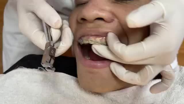 BUNG LỤA CHO KHÁCH HÀNG LÔ VĂN MIỀN RĂNG KẸ