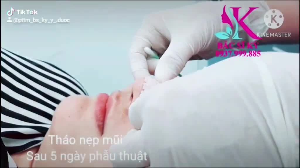 KHÁCH THÁO NẸP SAU 5 NGÀY PHẪU THUẬT