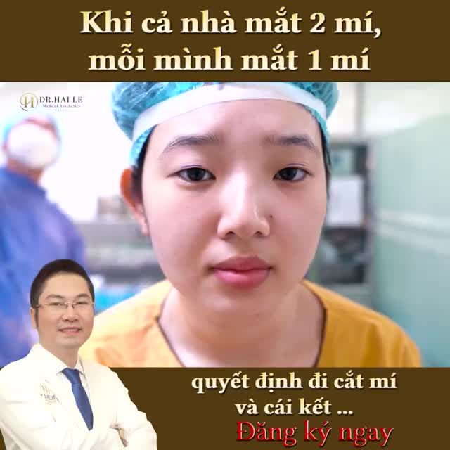 Biến hình sau 45 phút thẩm mỹ mắt tại Dr.Hải Lê