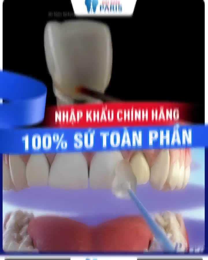 Thay Hàm Răng Xấu Đổi Nụ Cười Xinh