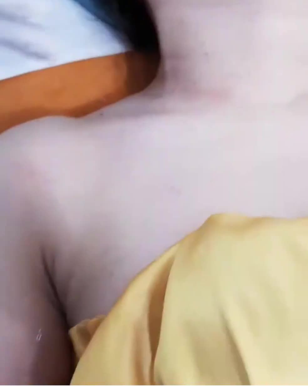 Mụn thịt vùng cổ Nổi trên tiết diện rộng