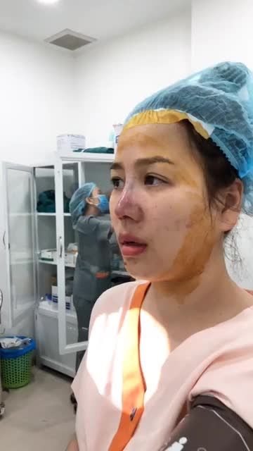 Dáng mũi Sline cao vừa đầu mũi bay do bác sĩ Sơn Tùng thực hiện