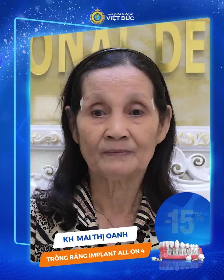 “ĐỘI NGŨ BÁC SỸ TẠI NHA KHOA QUỐC TẾ VIỆT ĐỨC RẤT GIỎI, TẬN TÌNH VÀ CHU ĐÁO”