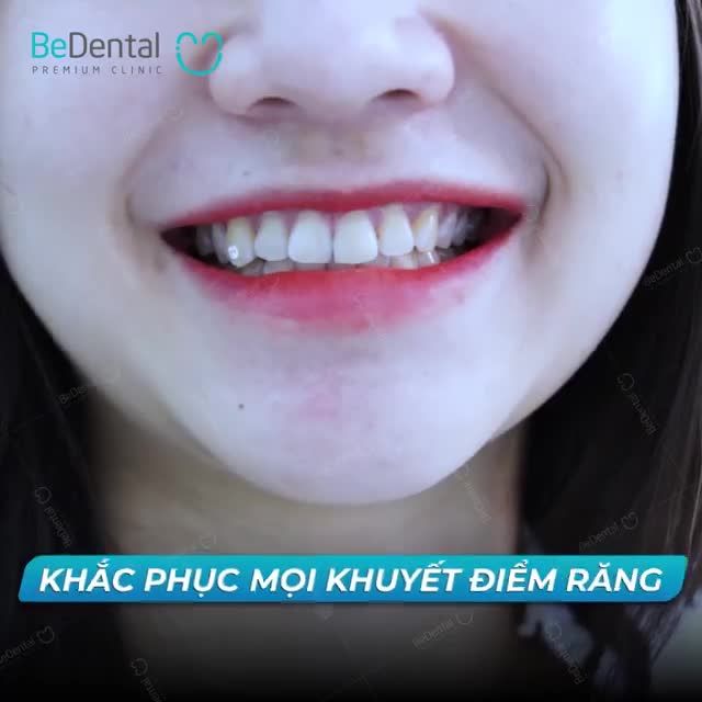 MUỐN SỞ HỮU RĂNG KHỎE ĐẸP? Mời bạn vào team của Bedental