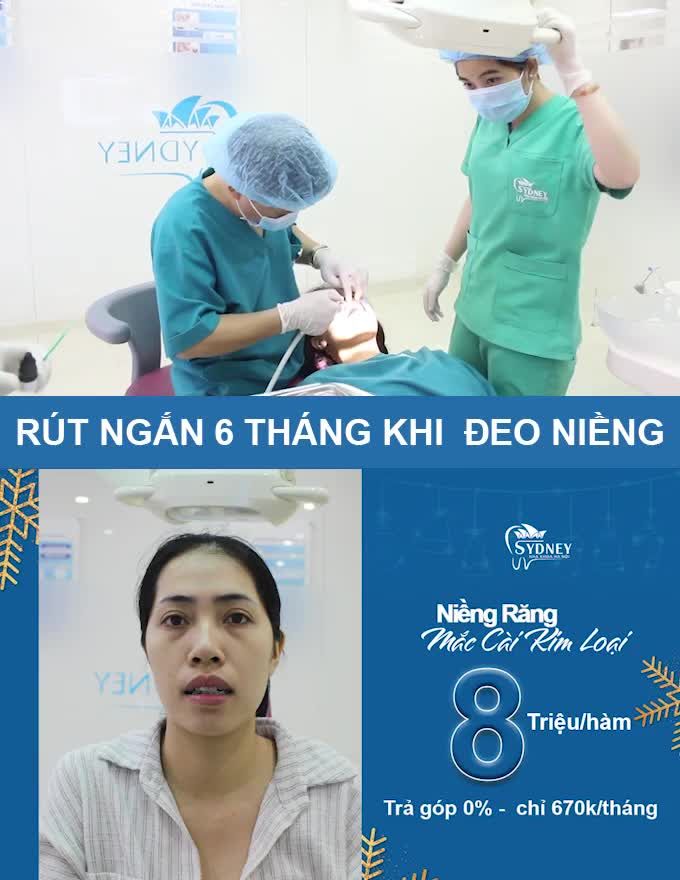 TẠI SAO BẠN CẦN NIỀNG RĂNG