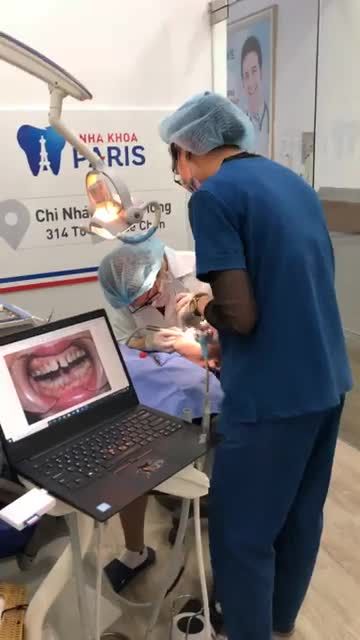 GẮN 24 RĂNG SỨ EMAX TẠI NHA KHOA PARIS HẢI PHÒNG
