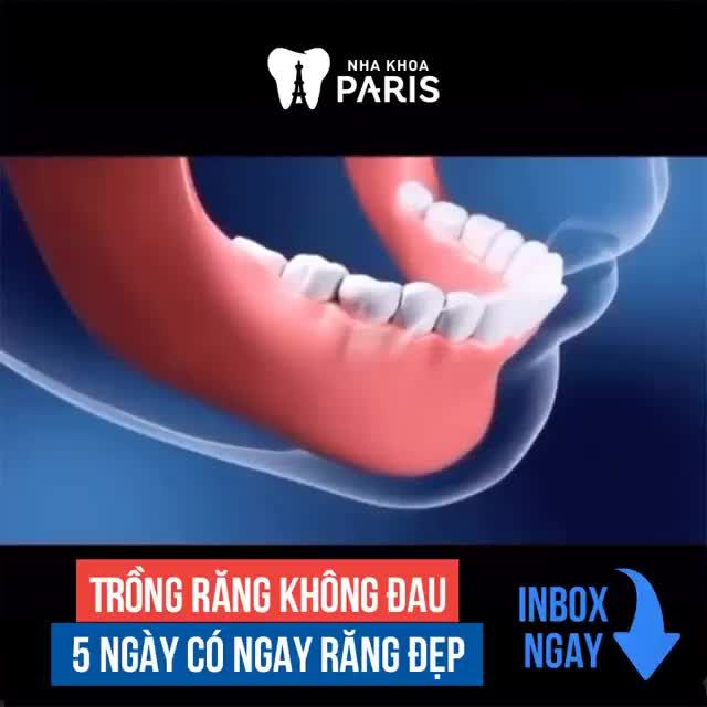 Mất Răng/Ăn Nhai Kém  Đừng thờ ơTrồng răng Implant Ăn nhai tốt