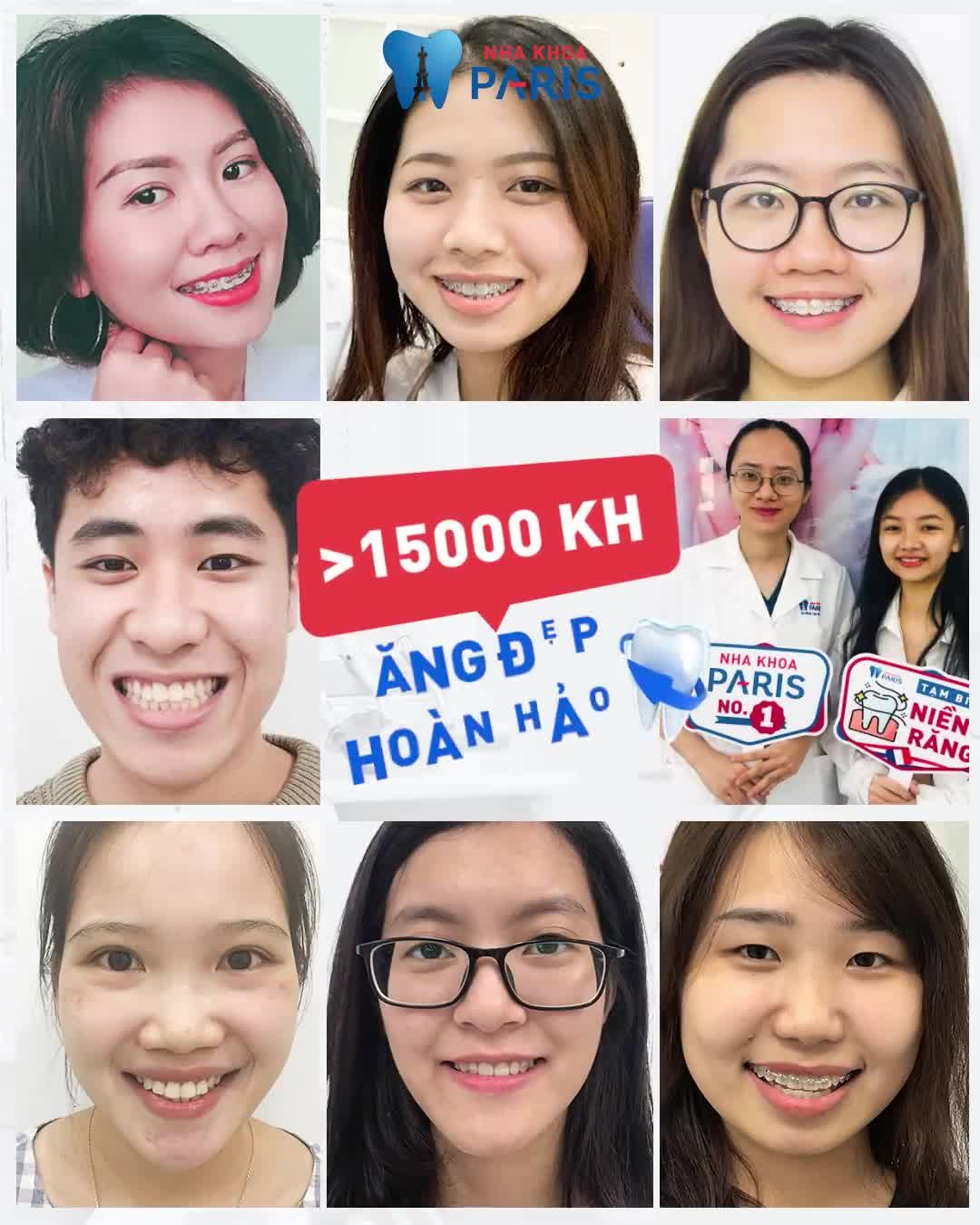Chia sẻ bí quyết RĂNG ĐỀU ĐẸP TỰ NHIÊN cười rạng rỡ