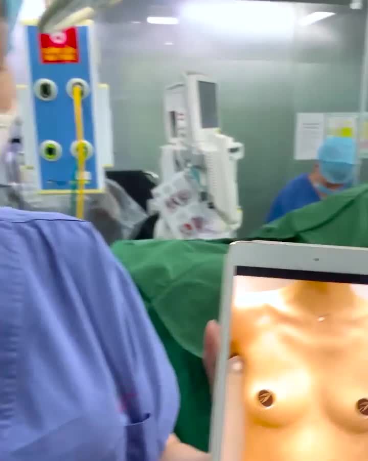 Kết quả sau Phẫu thuật nâng V1 Thẩm mỹ Saigon Young Bác sĩ Dương Văn Tươi