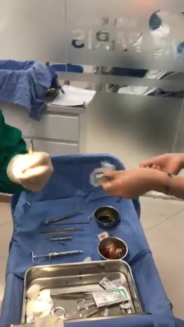 Bsi Hiệp căm IPL cho khách hàng