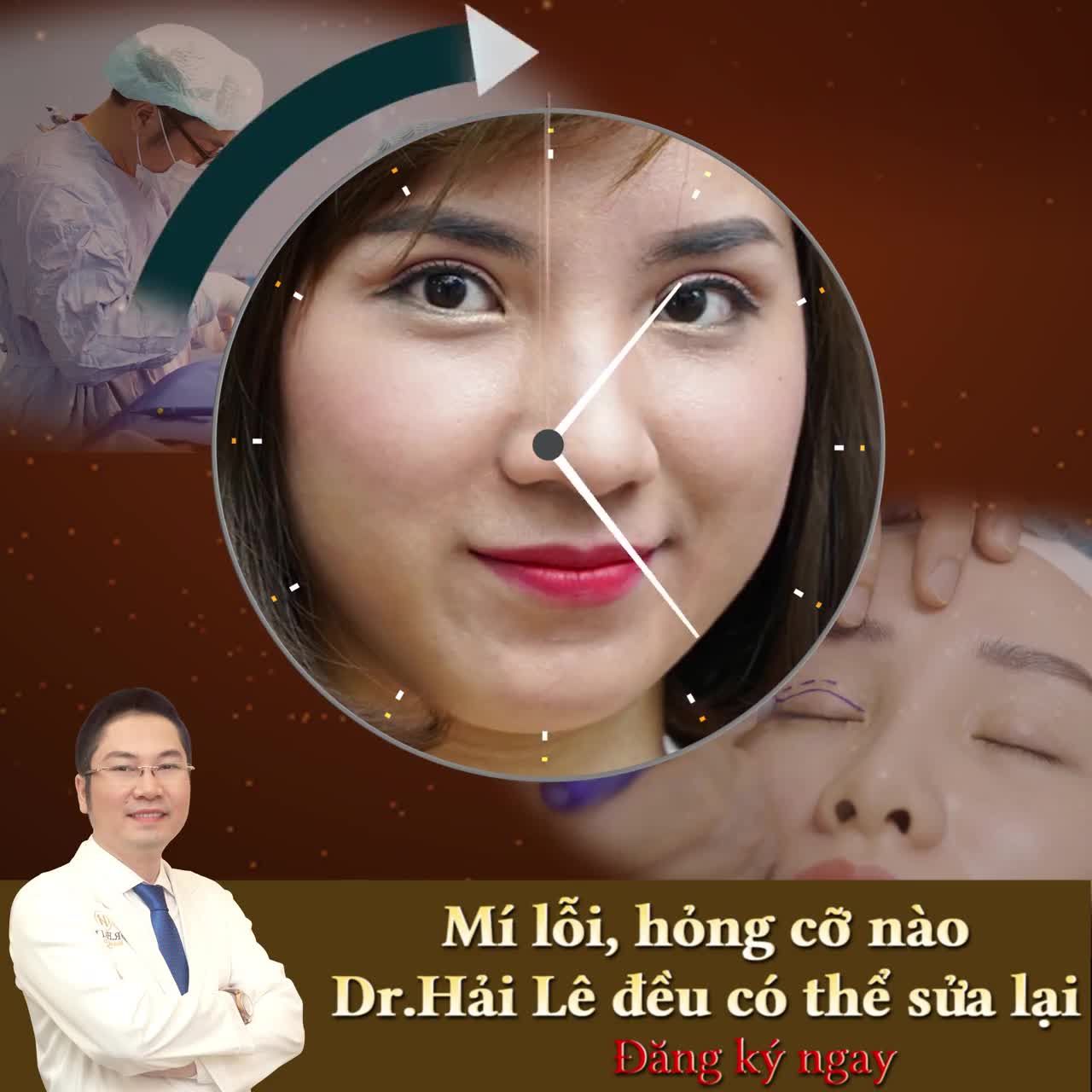Khách hàng sửa mí