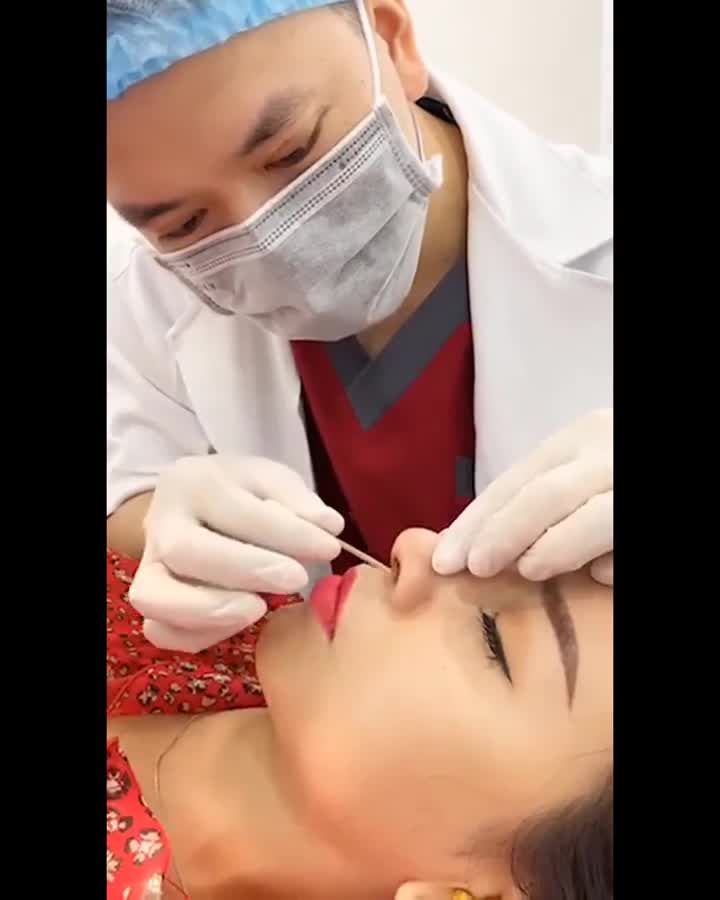 Quá đã! Sở hữu siêu phẩm NÂNG MŨI chưa bao giờ dễ đến thế