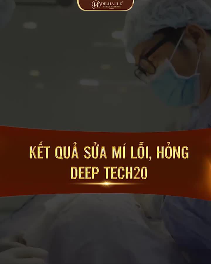 Đặt niềm tin sửa đúng chỗ nhận ngay kết quả đôi mắt đẹp xuất sắc