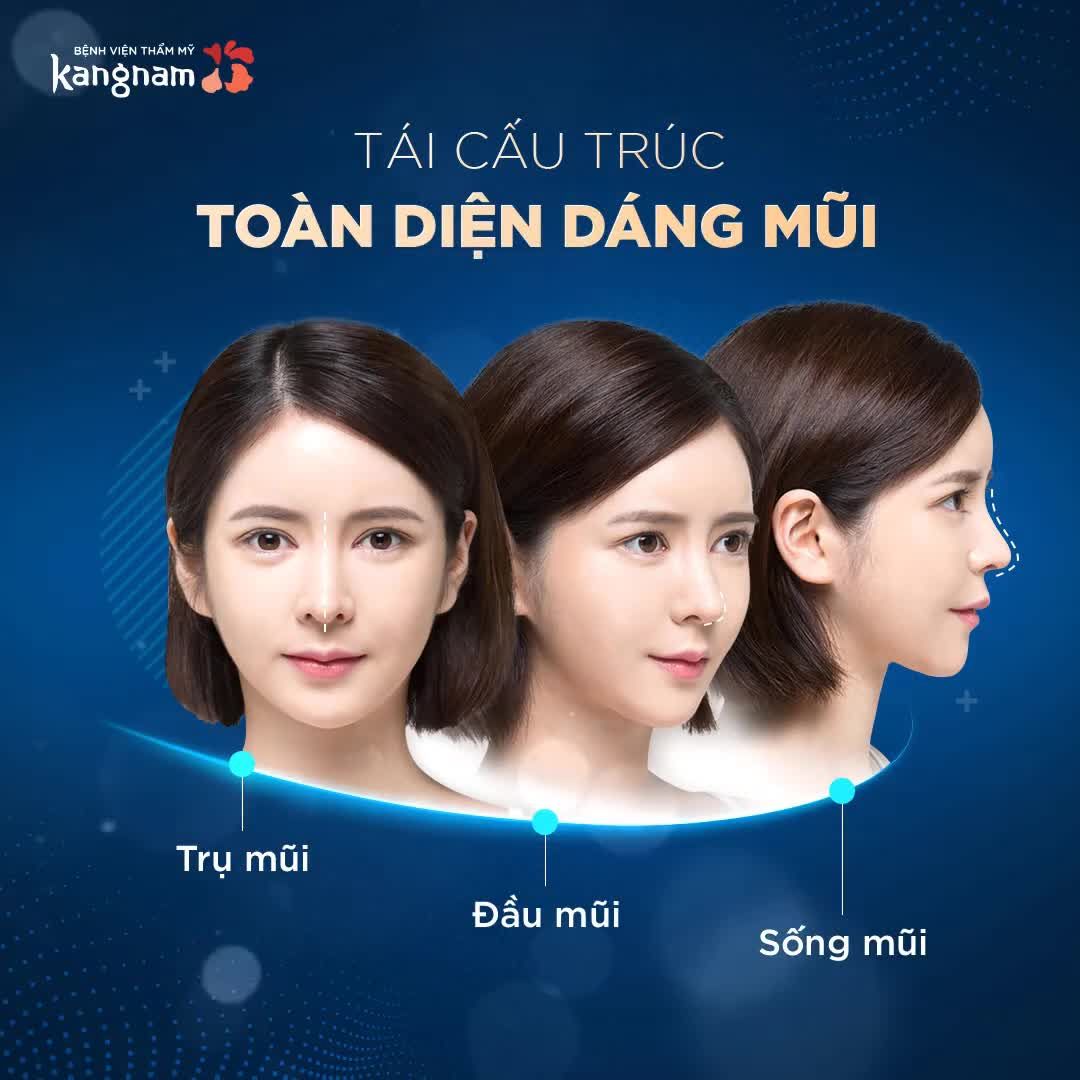 NÂNG MŨI CẤU TRÚC Chỉnh sống mũi Đầu mũi Trụ mũi