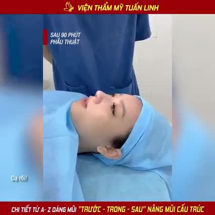 Chi tiết từ A-Z quá trình TRƯỚC TRONG  SAU khi nâng mũi cấu trúc của khách hàng Duyệt Trinh nhà Tuấn Linh