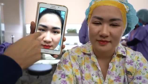 COMBO CẮT MÍ MỞ RỘNG GÓC MẮT MẮT ĐẸP “NỨC LÒNG”