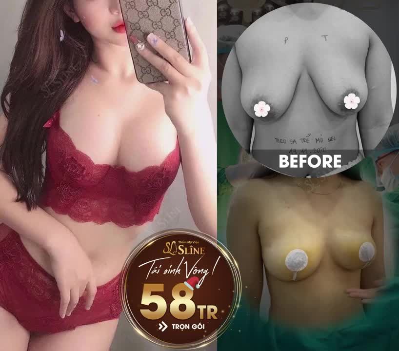 VÒNG 1 CHẢY XỆ THÌ VỀ SLINE