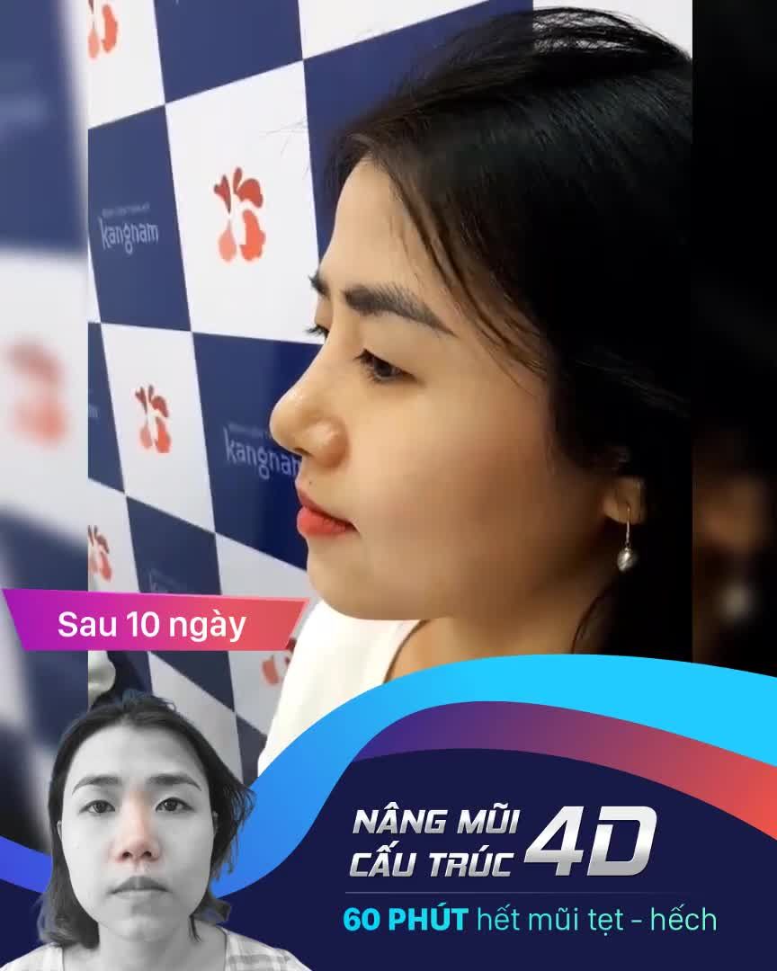 CHIẾC MŨI CỨU CẢ KHUÔN MẶT
