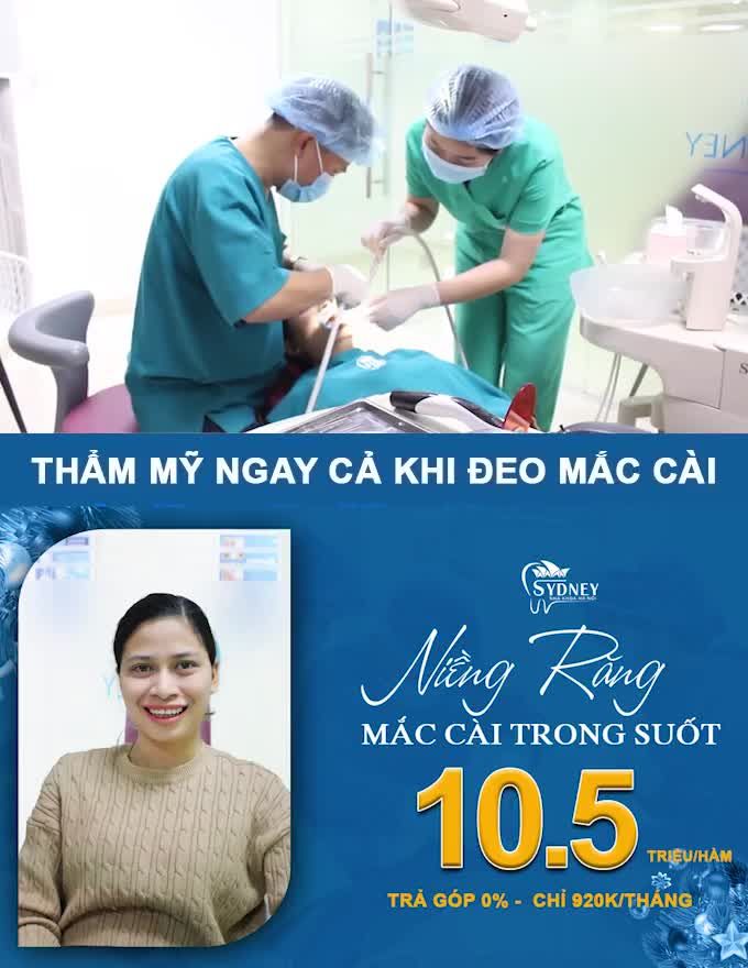 NIỀNG RĂNG PHA LÊ 10,5TR/HÀM