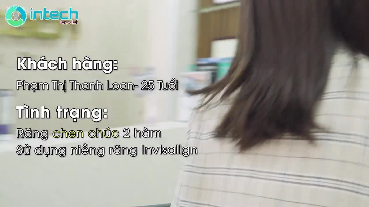 THEO CHÂN KHÁCH HÀNG GẮN ATTACHMENT VÀ NIỀNG RĂNG INVISALIGN