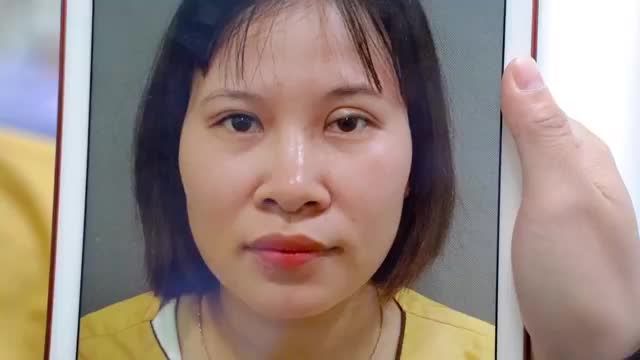 DR.HẢI LÊ GIẢI CỨU TẤT CẢ NHỮNG CA MÍ LỖI HỎNG THÀNH CÔNG NGOÀI SỰ MONG ĐỢI BẰNG KỸ THUẬT DEEPTECH20