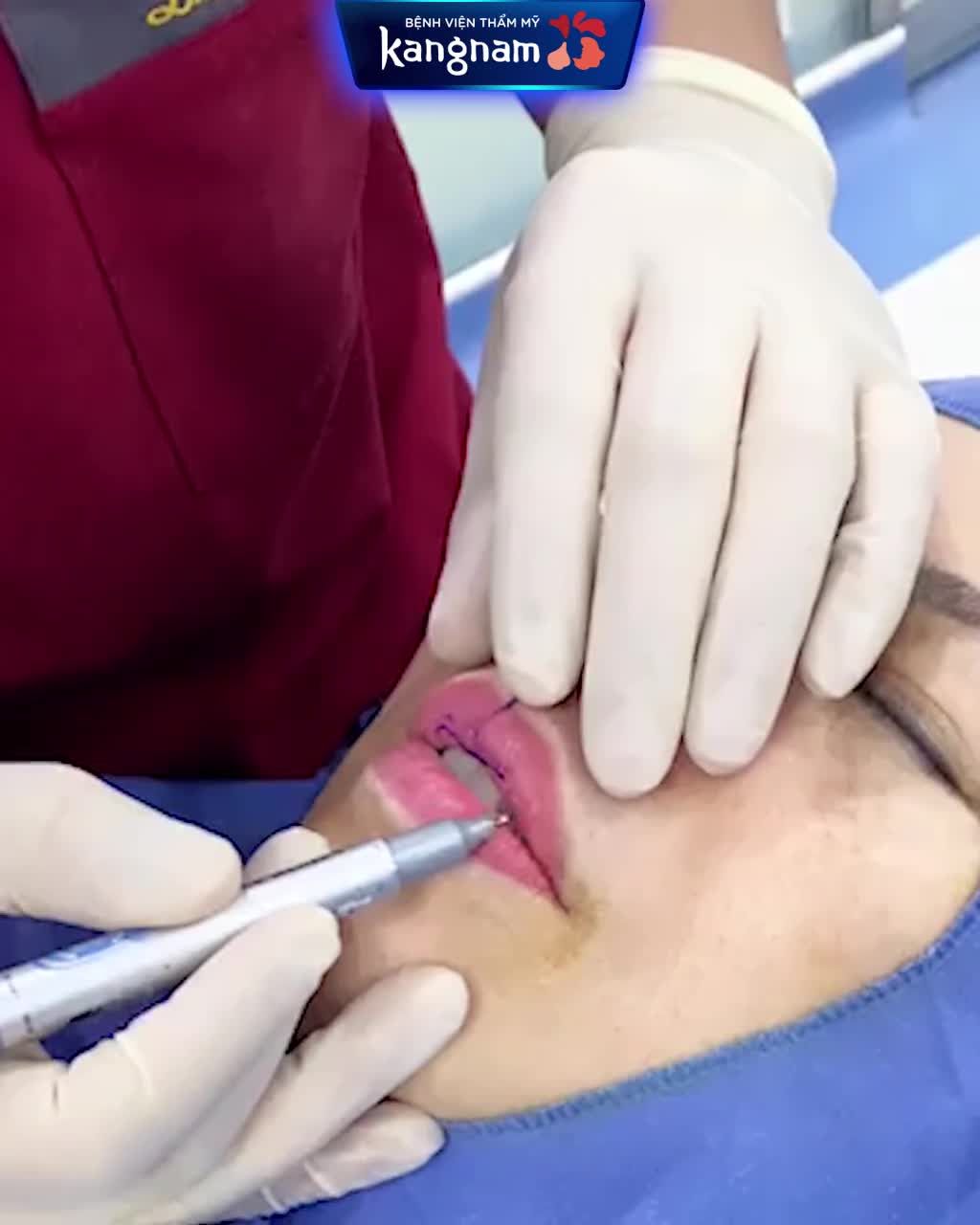 MÔI TRÁI TIM chuẩn xu hướng Mặt thêm điểm nhấn