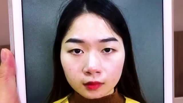 "Hô biến" Mắt 1 mí thành 2 mí tươi trẻ rạng ngời chỉ sau 45 phút thực hiện