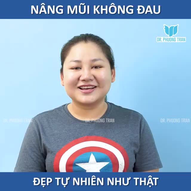 KẾT QUẢ THỰC TẾ SAU 14 NGÀY NÂNG MŨI ĐẶT SỐNG BỌC SỤN TAI