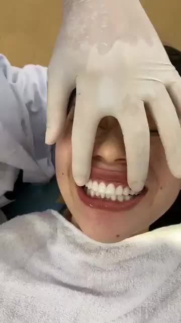 Khách hàng đang trải nghiệm dịch vụ làm răng thẩm mỹ thực tế tại Đà Nẵng do bác sĩ Tuấn trực tiếp thực hiện.