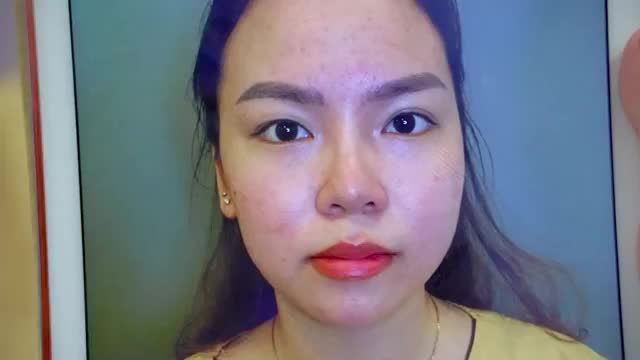 MÍ ĐẸP XINH KHÔNG SƯNG NỀ NHIỀU CHỈ SAU 45 PHÚT THỰC HIỆN TIỂU PHẪU THẨM MỸ MẮT TẠI DR.HẢI LÊ