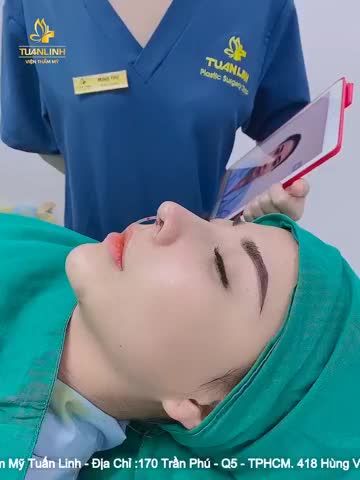 NÂNG MŨIC ẤU TRÚC SAU 90 PHÚT PHẪU THUẬT