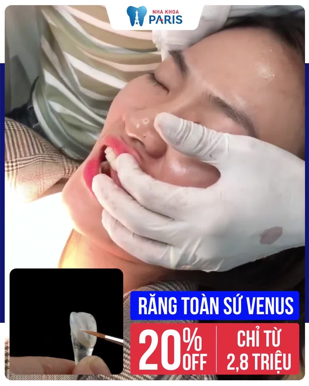 Bọc Răng Sứ " BÙNG CHÁY " giảm tới 60%