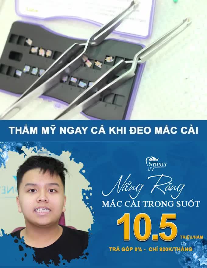KHẮC PHỤC TÌNH TRẠNG RĂNG "TRANH NHAU LÀM TỔ TRƯỞNG"