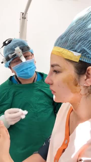 Mũi cấu trúc Surgiform ít sưng ít bầm