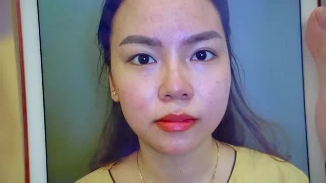 Chiêm ngưỡng ca mí vừa thực hiện xong đẹp lung linh, ít sưng, không đau