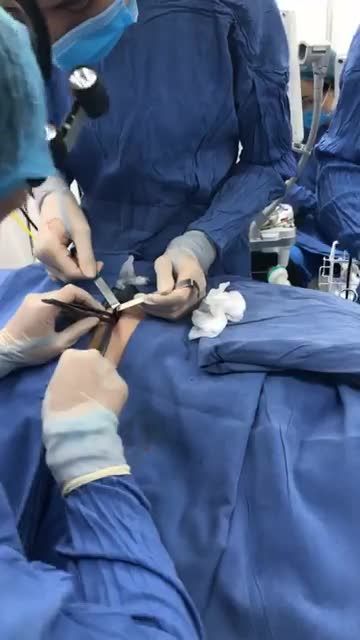 Cận cảnh Quy trình phẫu thuật TÁCH SỤN SƯỜN - NÂNG MŨI SỤN TỰ THÂN tại kangnam
