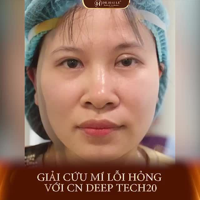 Tin tưởng SPA, tin tưởng NGƯỜI QUEN để rồi tiếc nuối