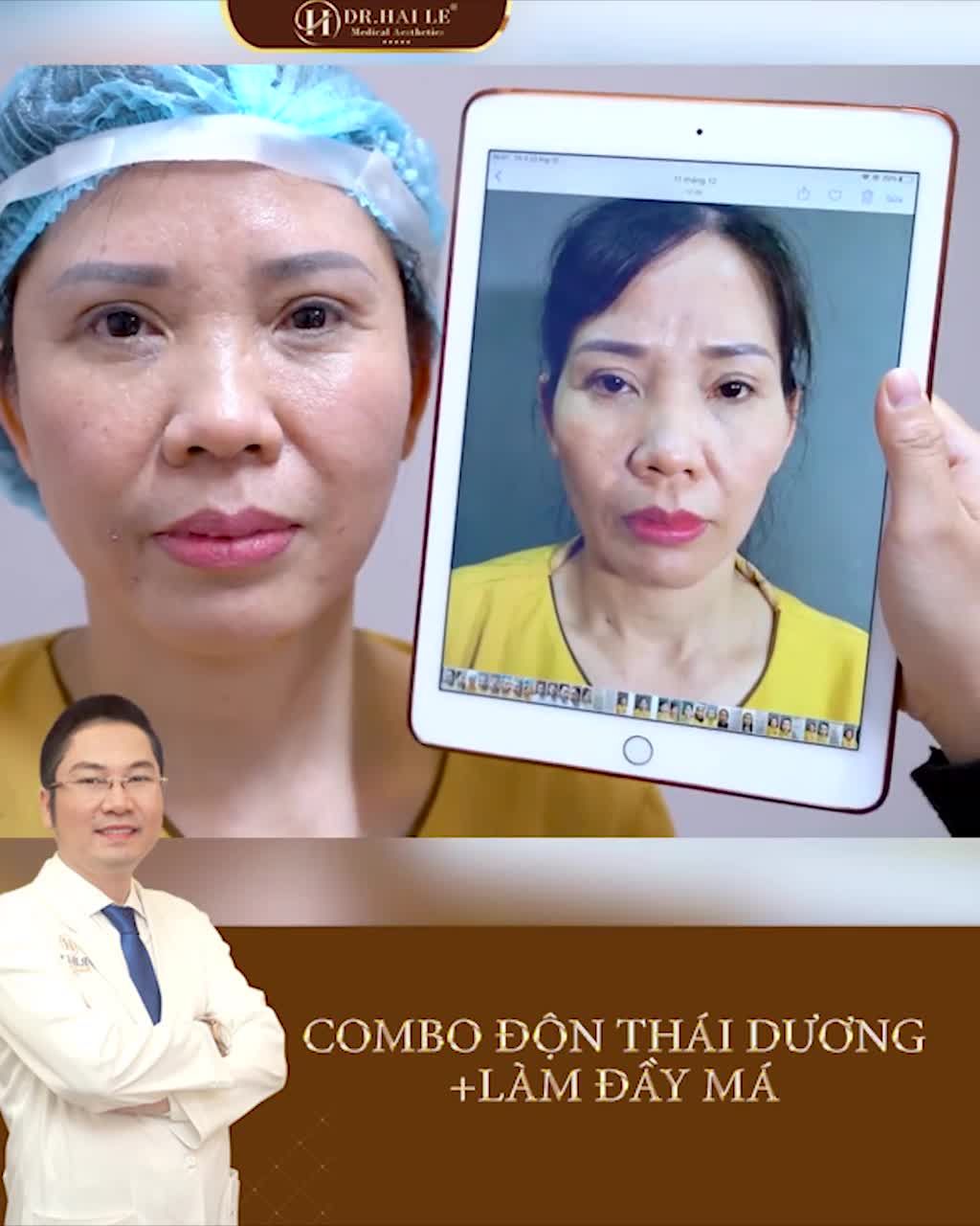 Gò má cao; thái dương hóp; mặt hốc hác. ĐÂU LÀ GIẢI PHÁP?