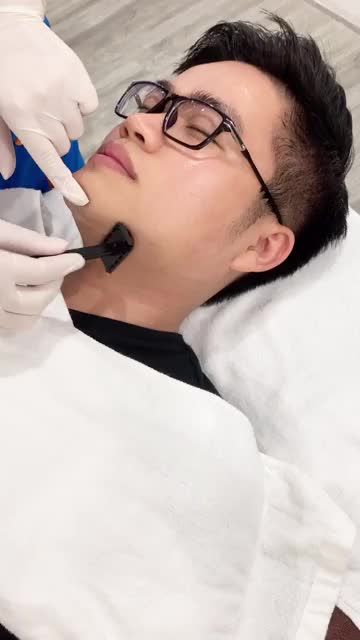 Triệt râu hiệu quả sau 4 lần với công nghệ Laser của BVTM Kangnam