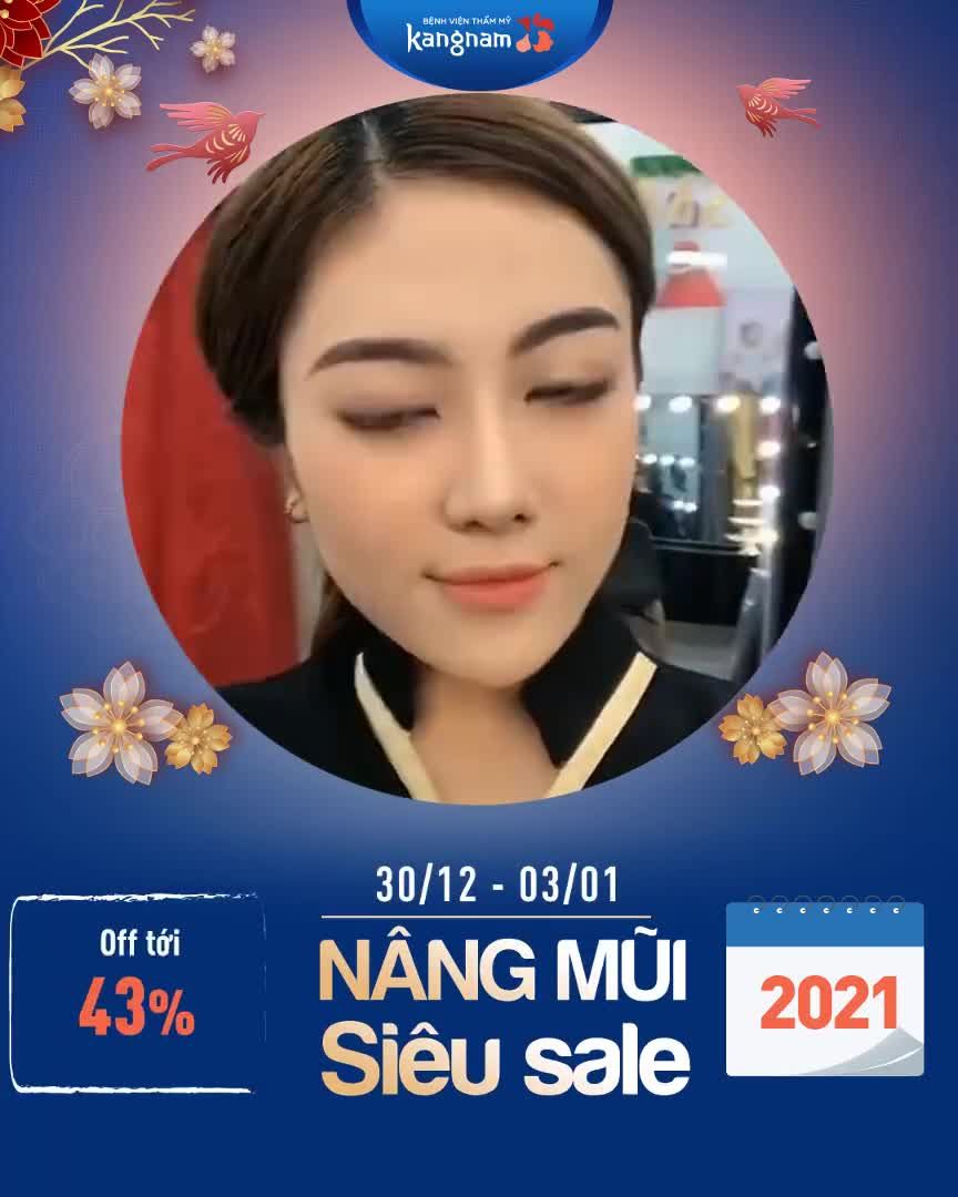 Giật mình ưu đãi NÂNG MŨI chào 2021