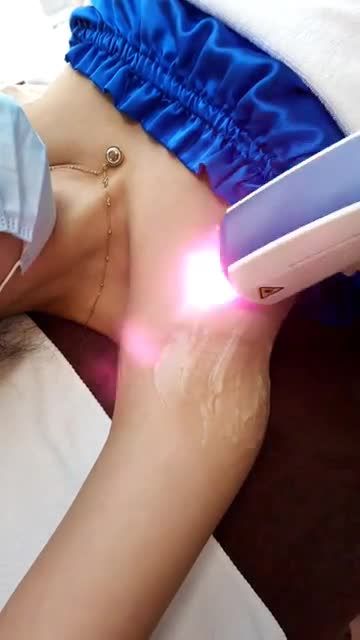 Lông nách rậm, đen vì NHỔ Thế thì phải TRIỆT NGAY!