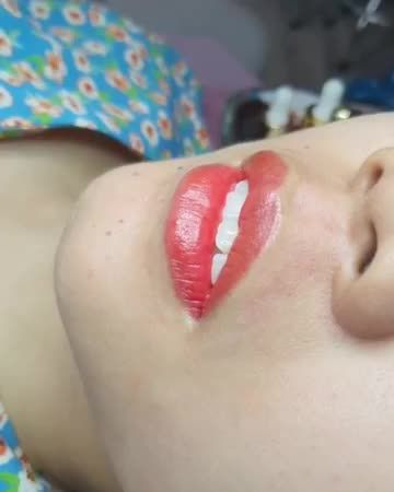 Phun môi cao cấp đón Tết Babylips  môi đẹp tức thì, ít sưng, môi căng, màu mịn tự nhiên tại Dr.Hải Lê