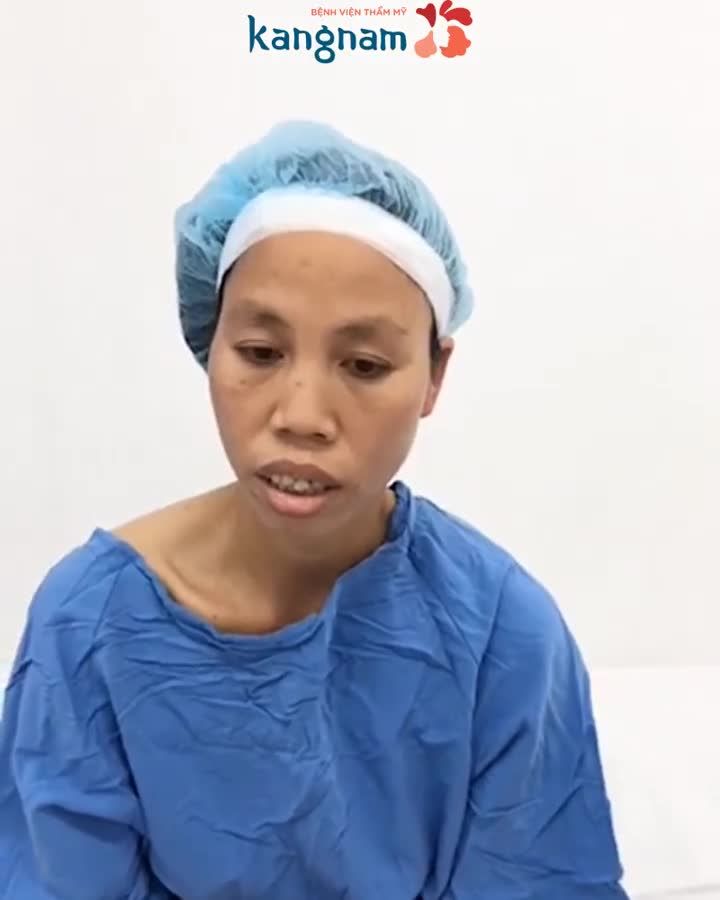 Hô nặng, quá phát 2 hàm trên dưới, khó khăn trong việc ăn nhai