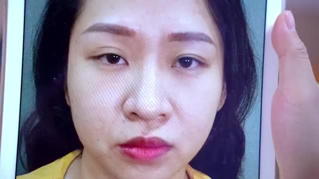 Tại Dr.Hải Lê dù mắt khó ở mức độ nào đội ngũ Bác sĩ đều có thể khắc phục giúp bạn sở hữu một đôi mắt đẹp rạng rỡ tự tin
