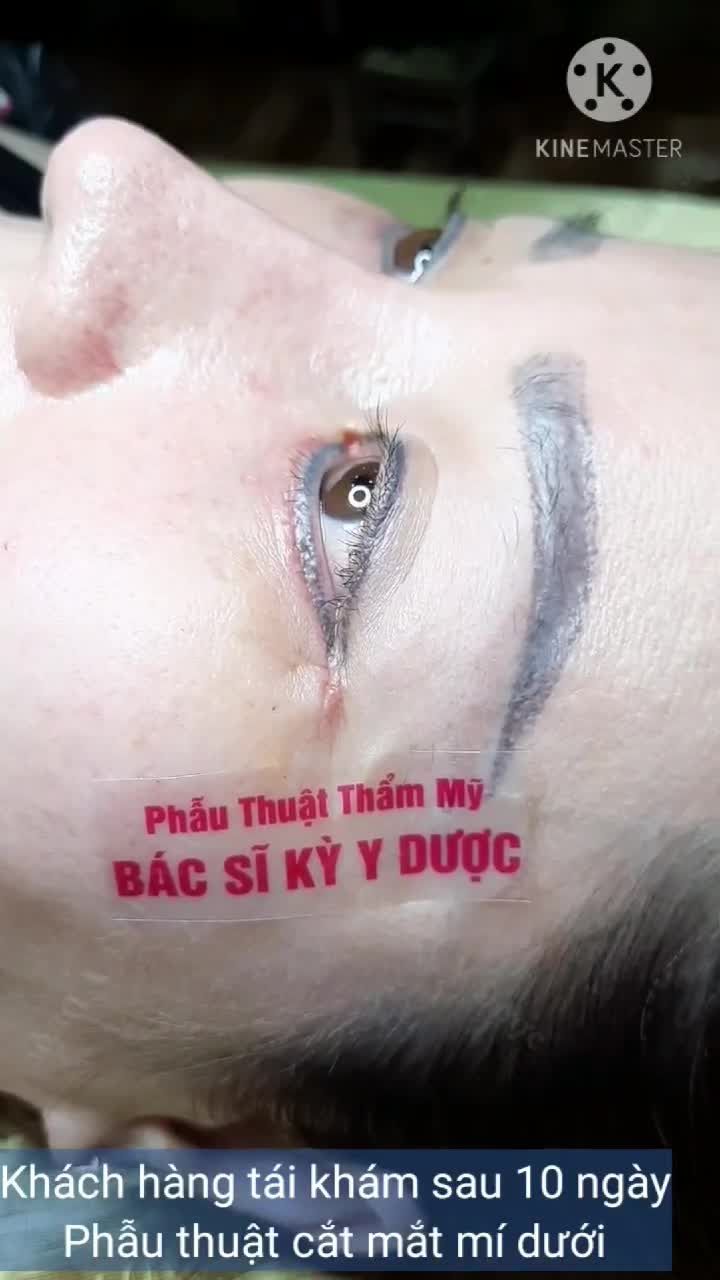Đôi mắt là cửa sổ tâm hồn Để có được đôi mắt đẹp hãy đến  Bs Kỳ Y Dược