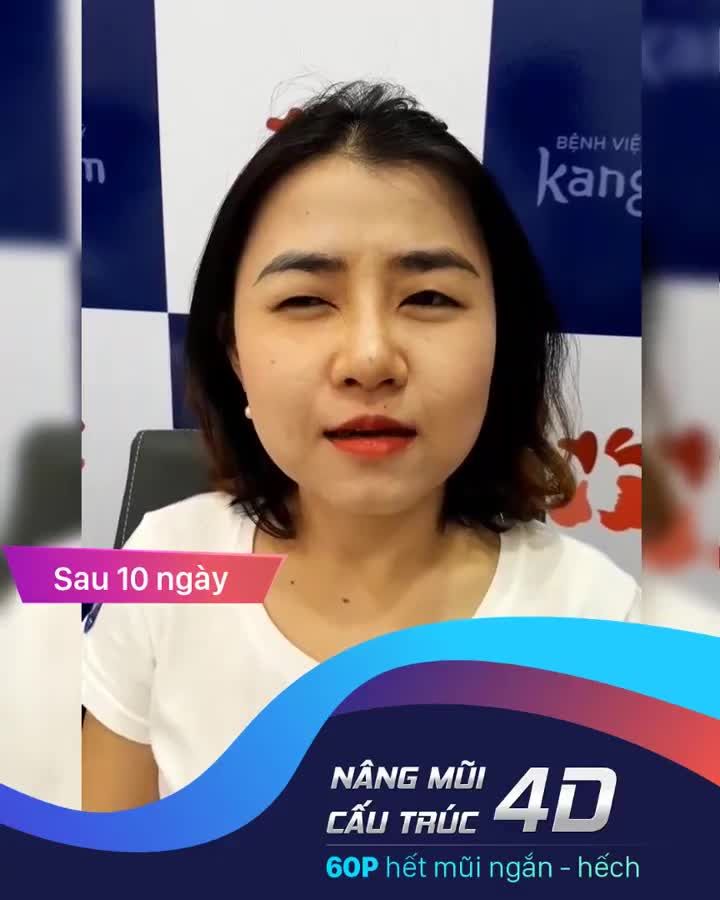 NÂNG MŨI CỨU CẢ KHUÔN MẶT chỉ từ 14TR