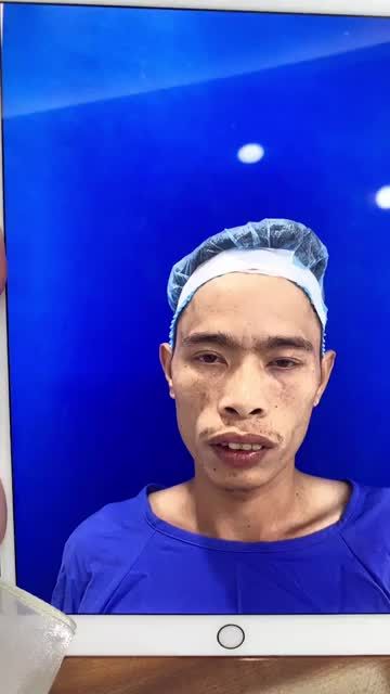 KHẮC PHỤC HÀM VẨU lột xác đến "nhận không ra"