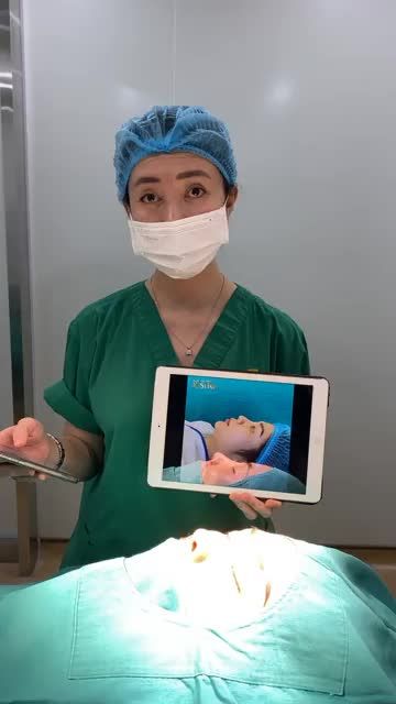 "Mũi khó" có Sline 1 ca mũi đã phẫu thuật tại cơ sở khác 3 năm